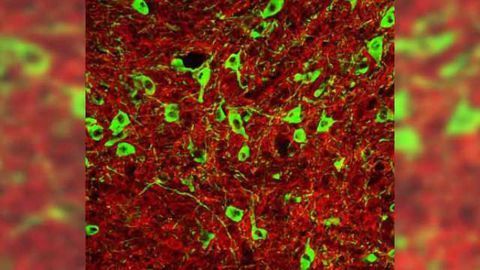 Stressed-out rats consume more alcohol, revealing related brain chemistry