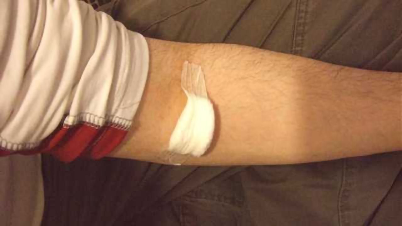 Game-changing blood test for concussions developed