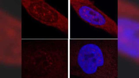 The messenger in Huntington's disease