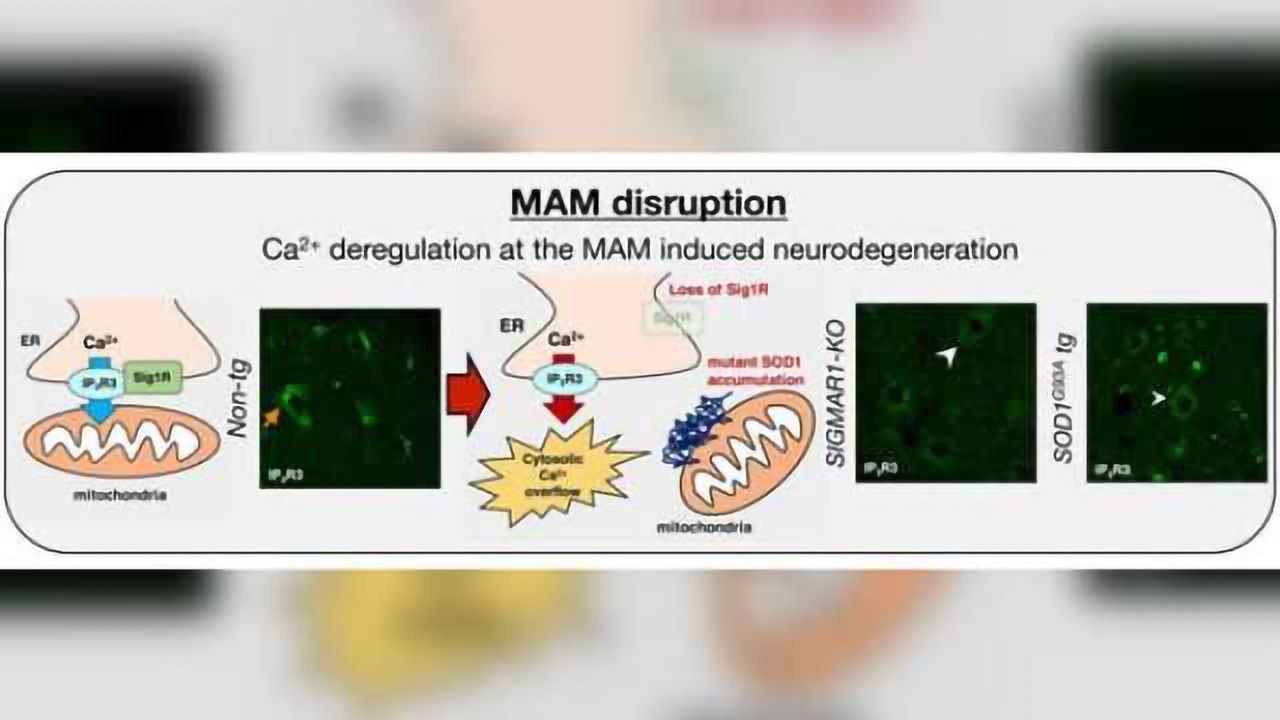 Collapse of mitochondria-associated membrane in ALS