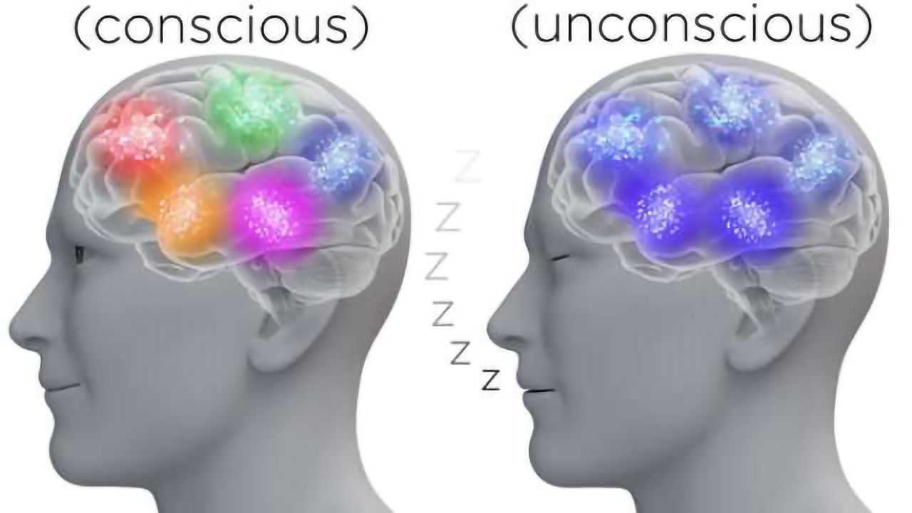 Anesthesia changes neuronal choreography