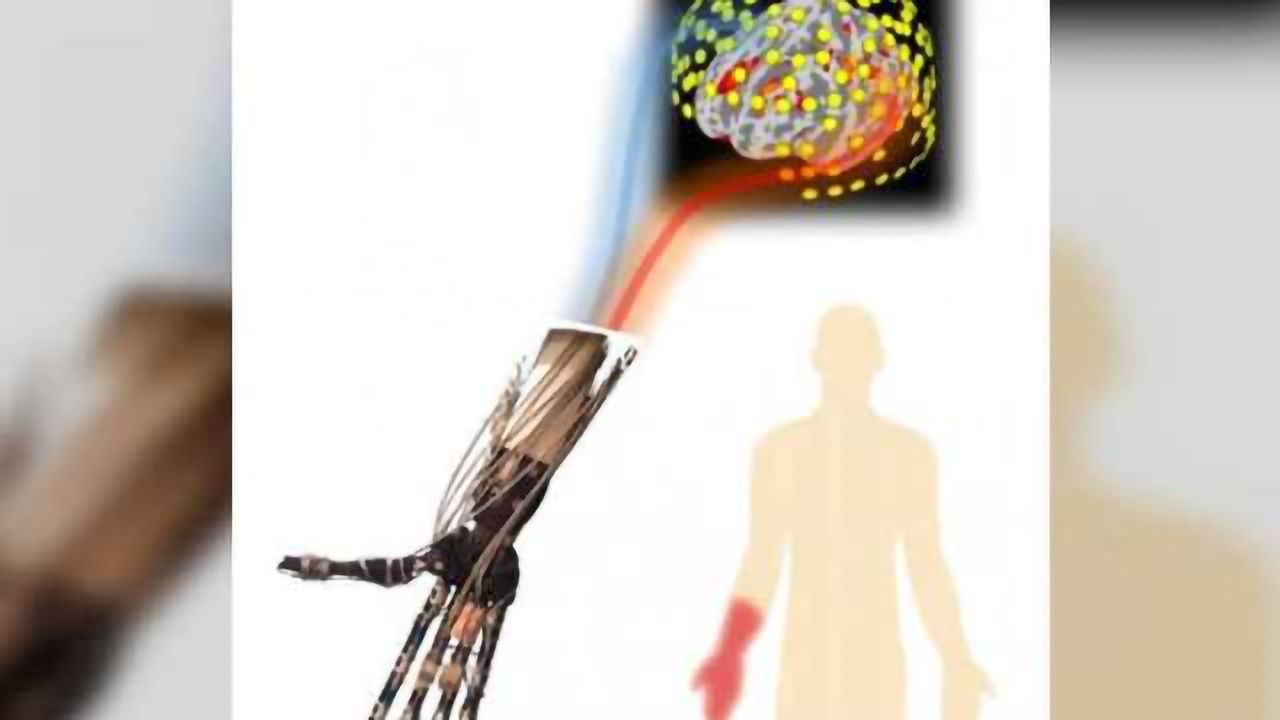 New insights into cause of phantom limb pain may have therapeutic benefits
