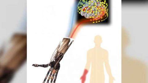 New insights into cause of phantom limb pain may have therapeutic benefits