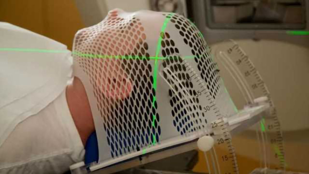 Study reveals new information on how brain cancer spreads