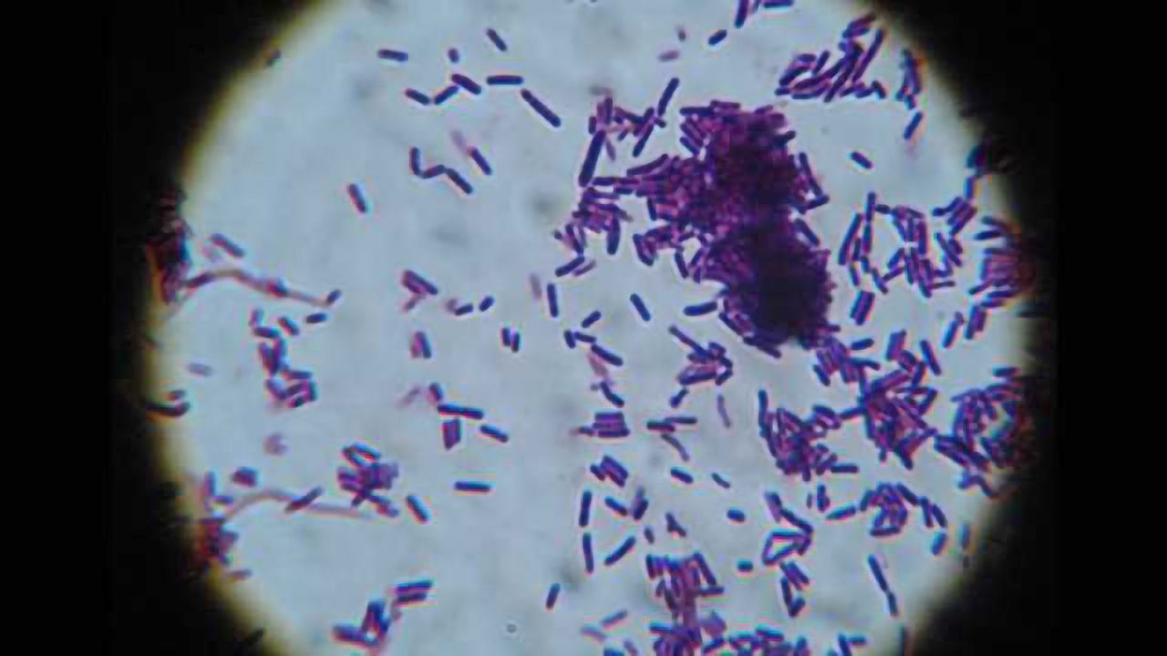 Common probiotics can lessen anxiety, reduce stress levels