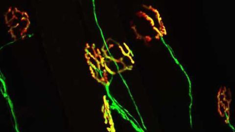 Protective molecule sidelined in models of ALS