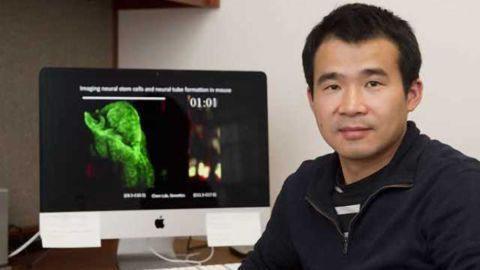 New mouse model reveals extensive postnatal brain damage caused by Zika infection