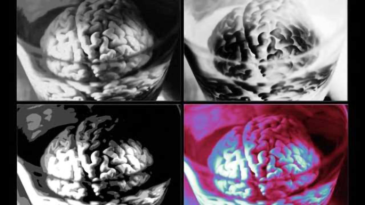 Scientists discover neuron-producing stem cells in the membranes covering the brain