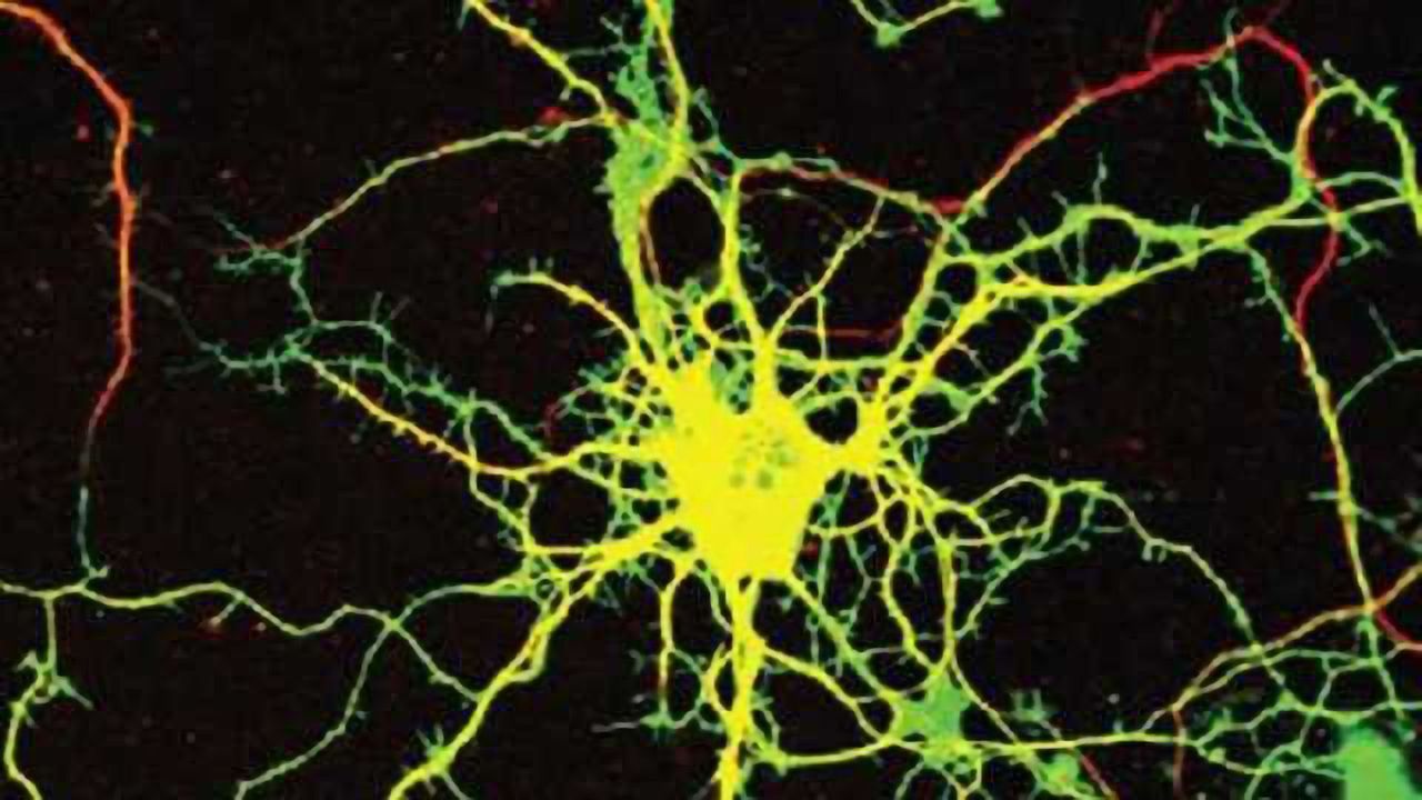 Gene discovered to cause rare, severe neurological disease
