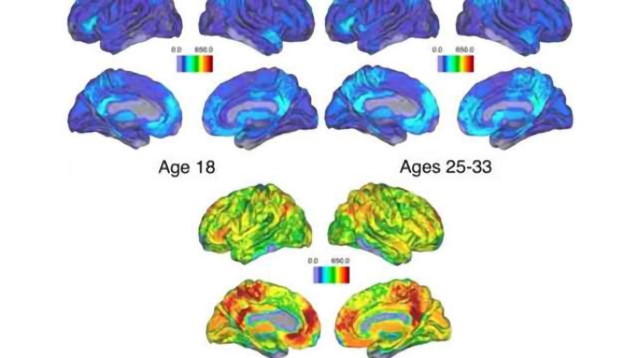 Memory-related brain activity loses cohesion as people age