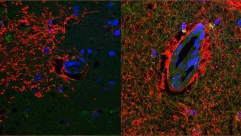 Study suggests possible new target for treating and preventing Alzheimer's