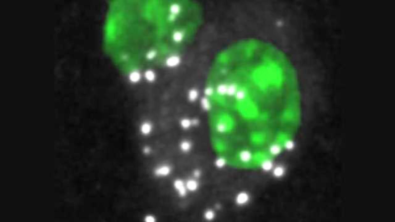 Multiple sclerosis: Newly discovered signal mechanism causes T cells to turn pathogenic