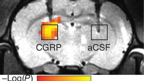 A radiation-free approach to imaging molecules in the brain