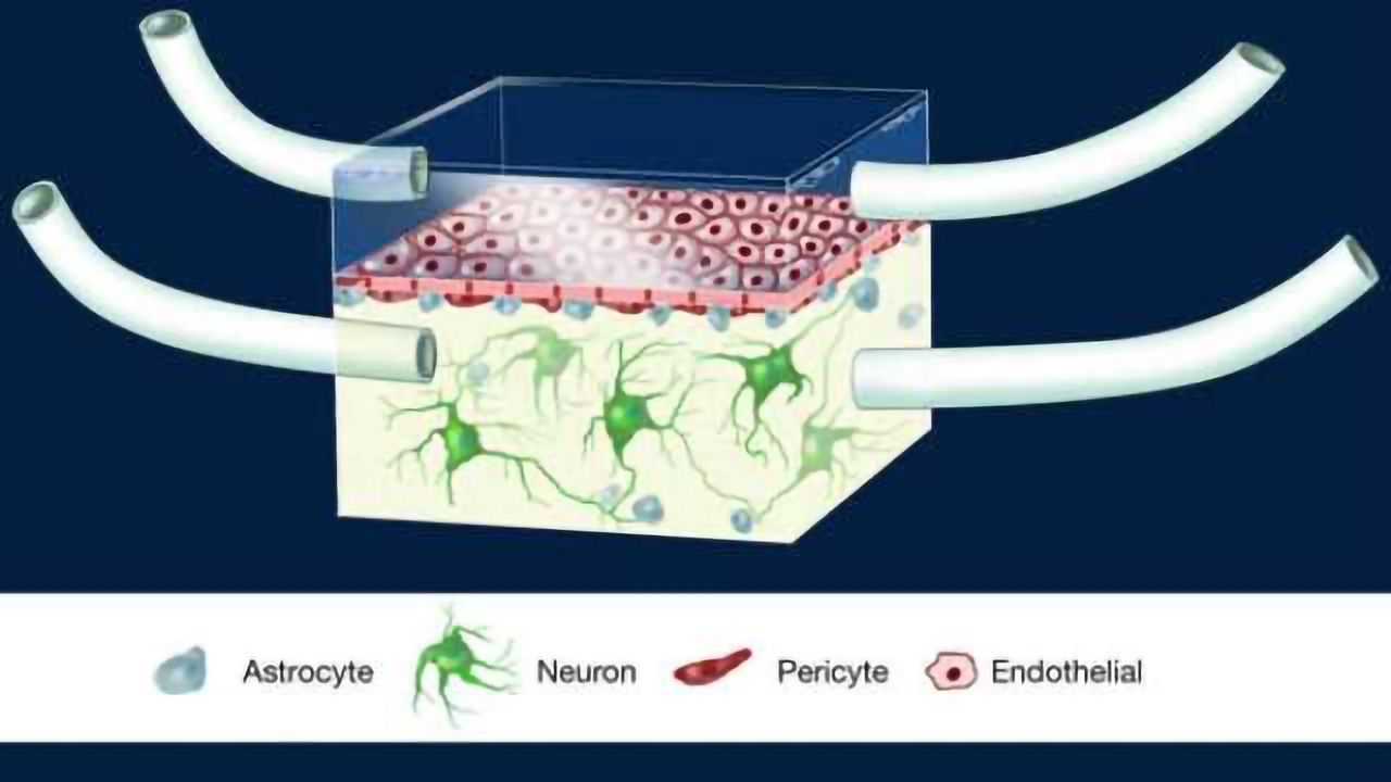 Blood-brain barrier on a chip sheds new light on 'silent killer'