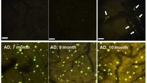 MAO is a possible Alzheimer's disease biomarker