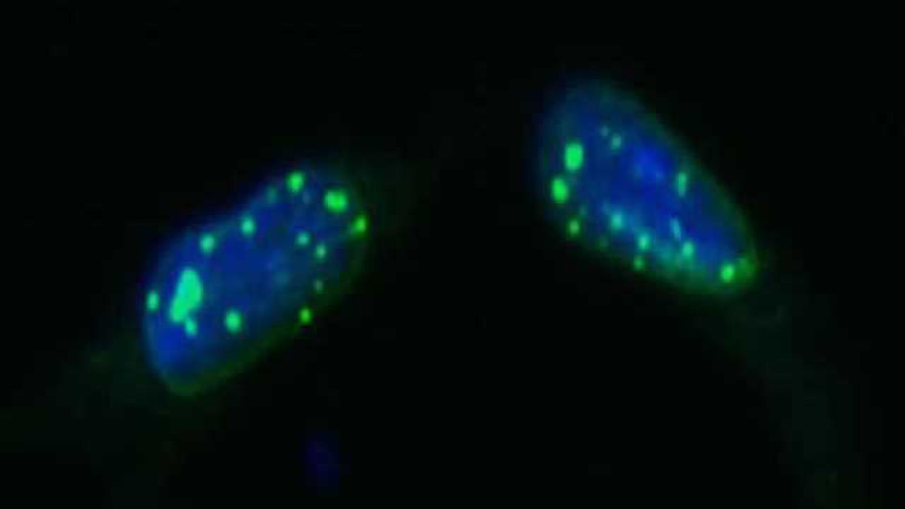 New drug screening tool developed for dystonia