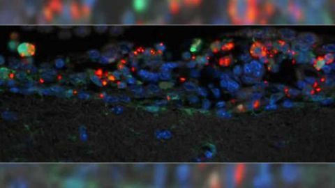 Scientists develop new mouse model to study Salmonella meningitis