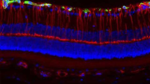 Female hormones increase risk of vision loss in rare genetic disease