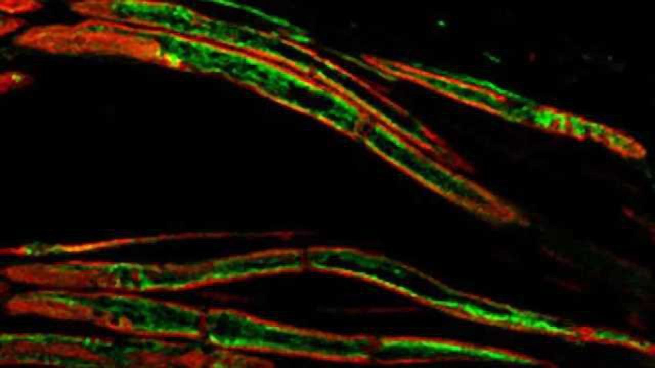 Study offers approach to treating pain