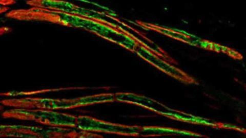 Study offers approach to treating pain