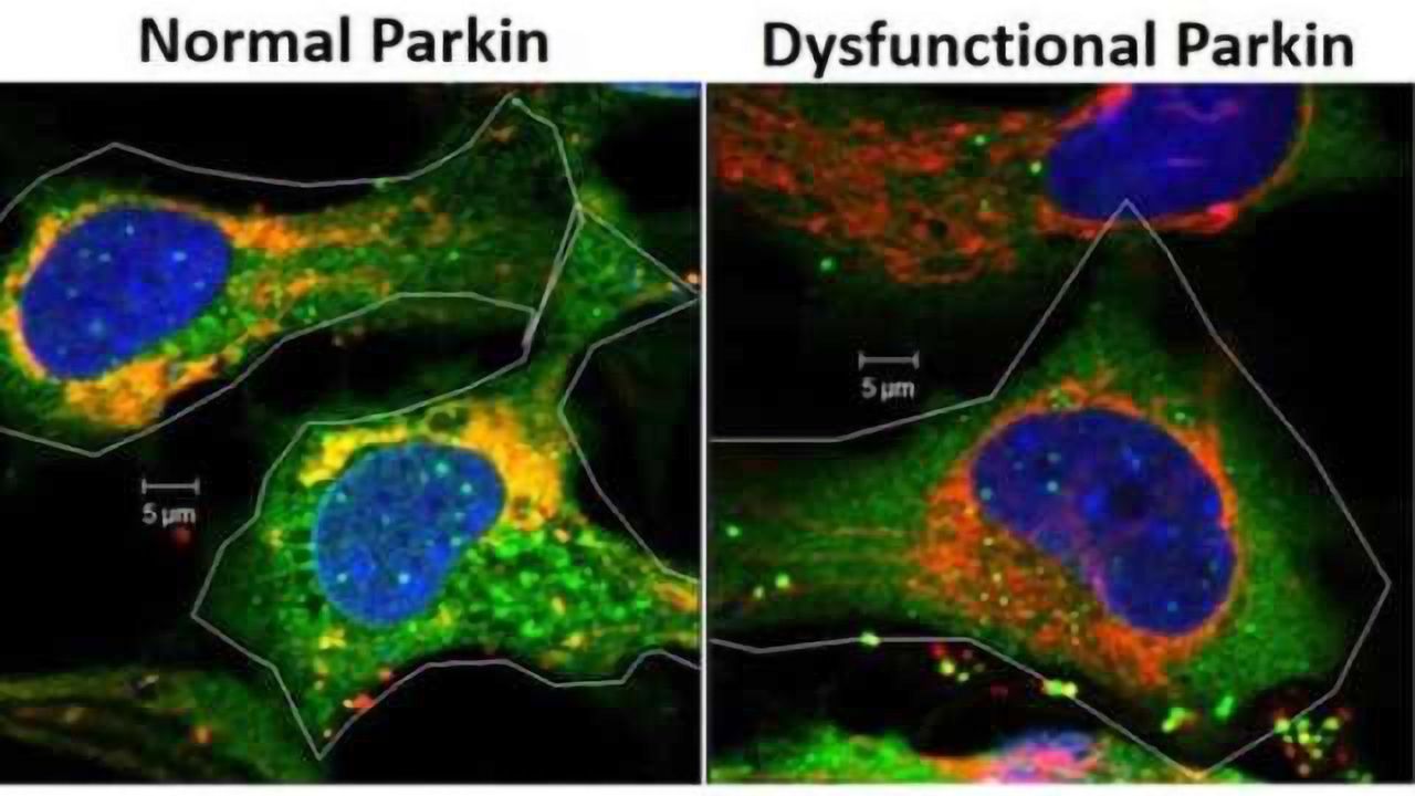 Study first to show role of Parkin gene in eye lens free radical formation, cell survival
