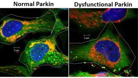 Study first to show role of Parkin gene in eye lens free radical formation, cell survival