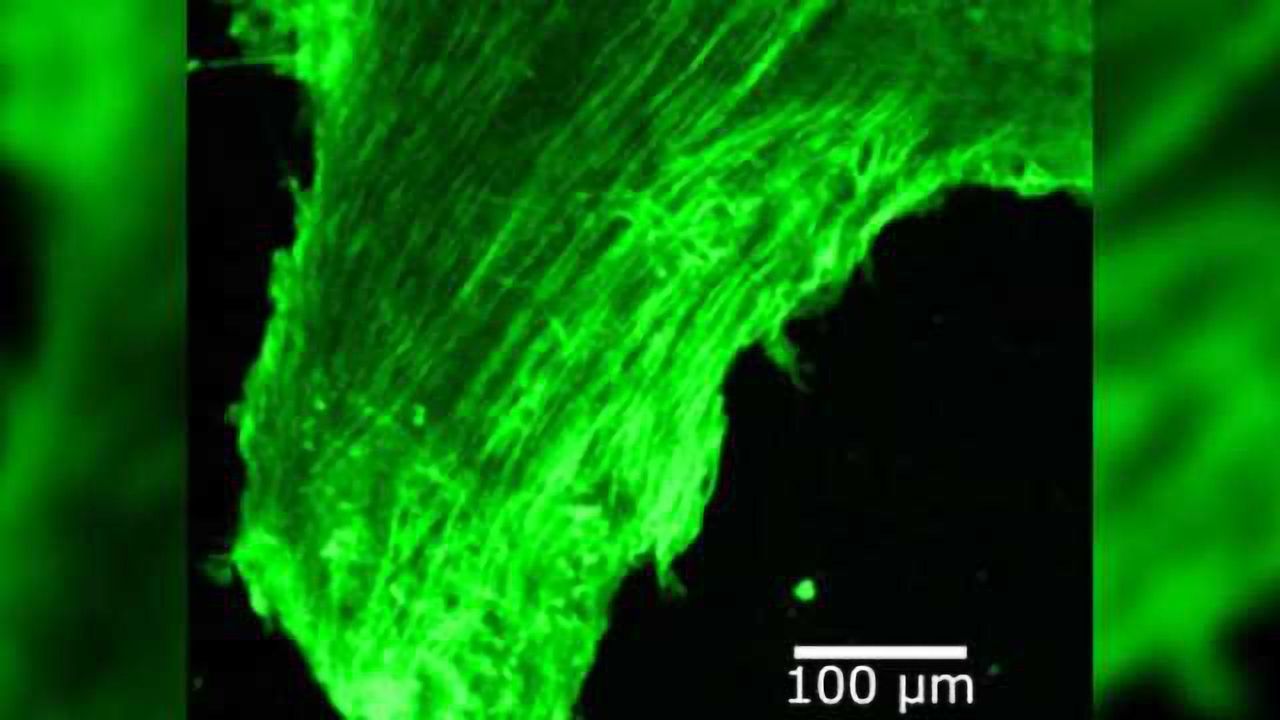 How hearing loss can change the way nerve cells are wired