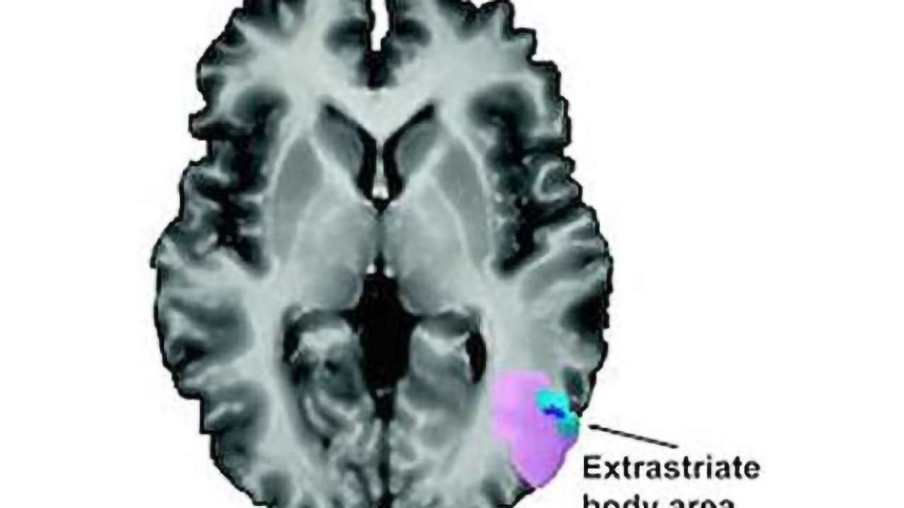 How hearing 'twist my arm' engages the brain