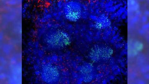 Gut cells are gatekeepers of infectious brain diseases, study finds
