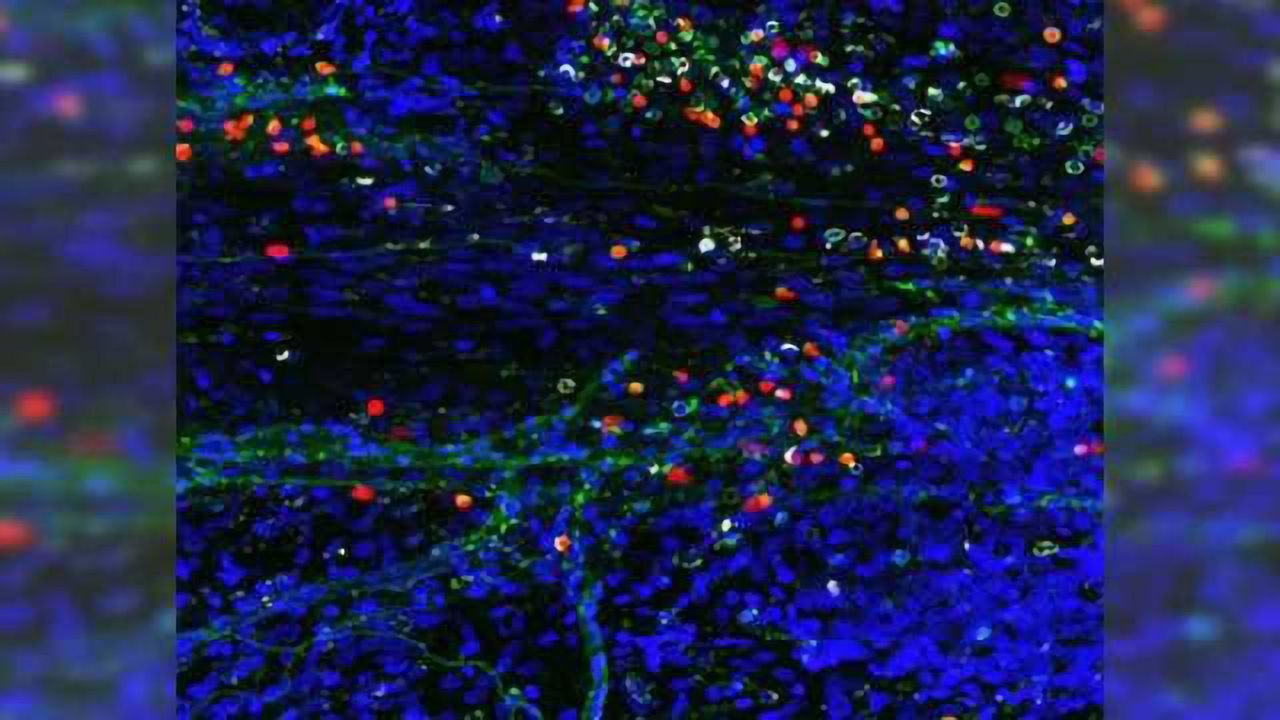 Powerful defenders of the brain discovered—with big implications for disease