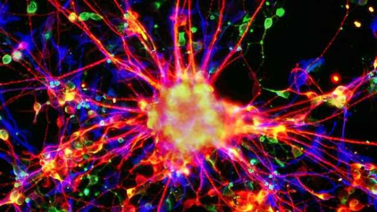 Stroke: Brain cells potentiate harmful electrical discharges