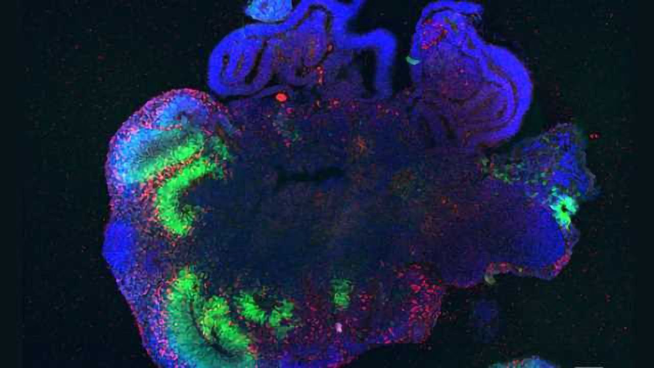 Building a better brain