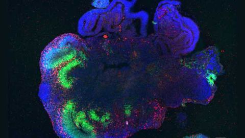Building a better brain