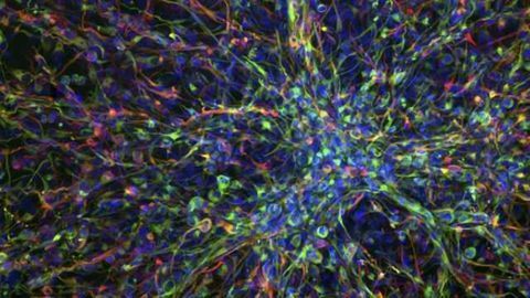 Some glioblastoma patients benefit from 'ineffective' treatment, researchers say