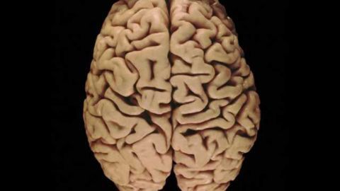 New disease could signal hope for sufferers of brain aging conditions