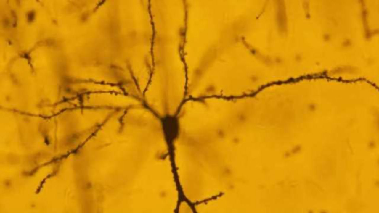 The late effects of stress: New insights into how the brain responds to trauma
