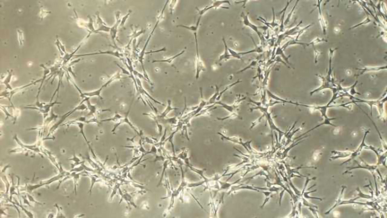 Single protein may hold secret to treating Parkinson's disease and more