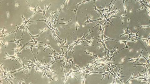 Single protein may hold secret to treating Parkinson's disease and more