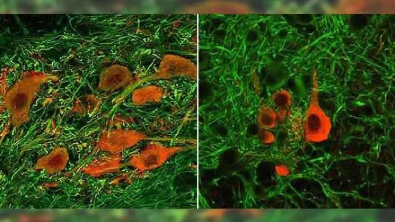 Experiments in mice may help boost newly FDA-approved therapy for spinal muscular atrophy