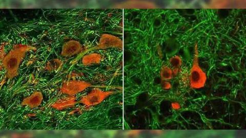Experiments in mice may help boost newly FDA-approved therapy for spinal muscular atrophy