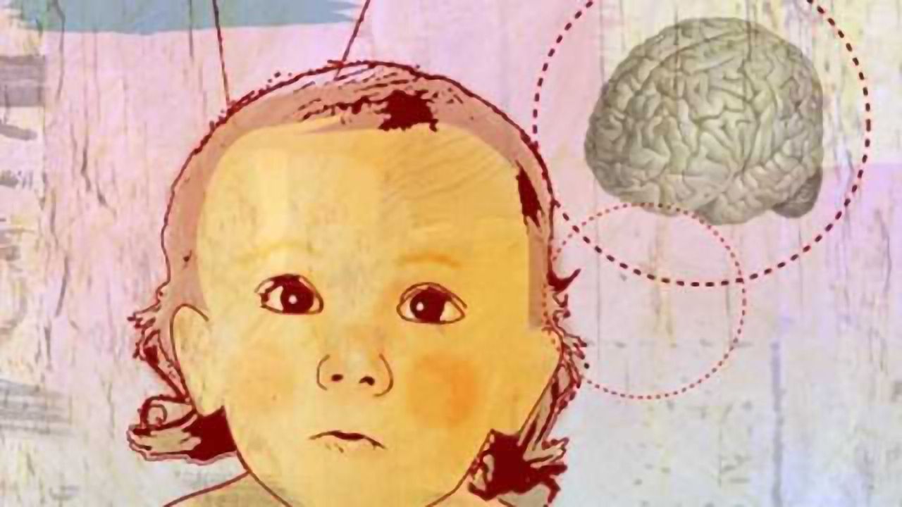 Brain responses to speech predict early language outcomes in children with autism