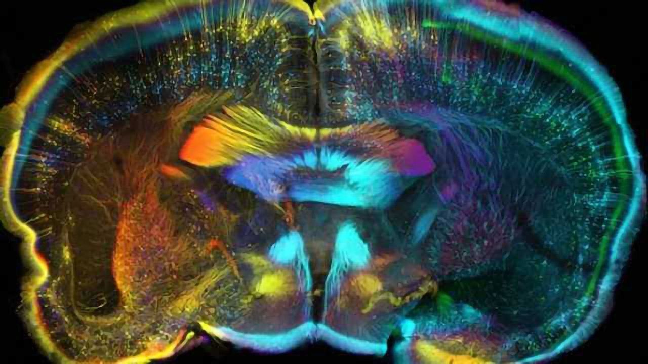 An eye opening look at adult visual plasticity