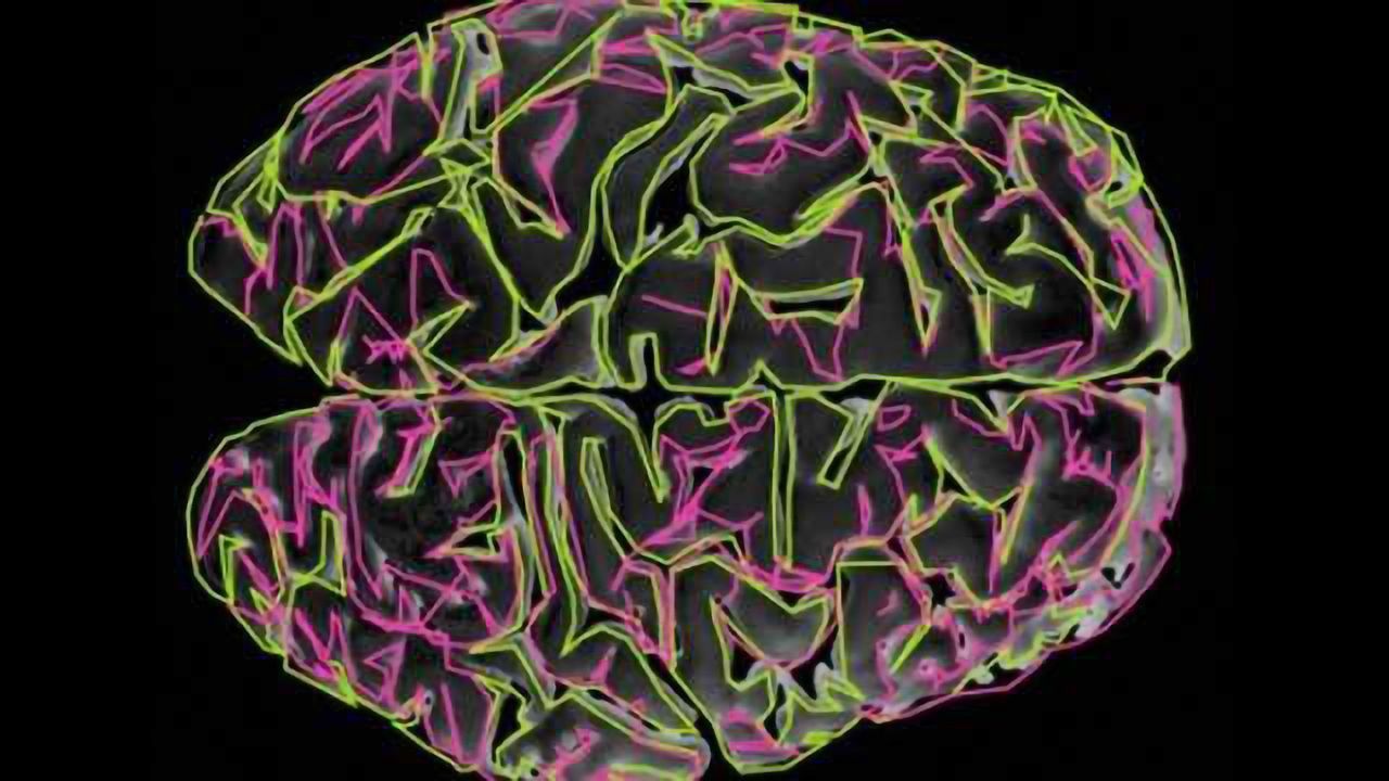 From transcription to function: mapping brain networks