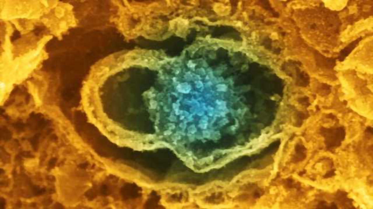 Homing in on the therapeutic mechanisms of commonly used antidepressants