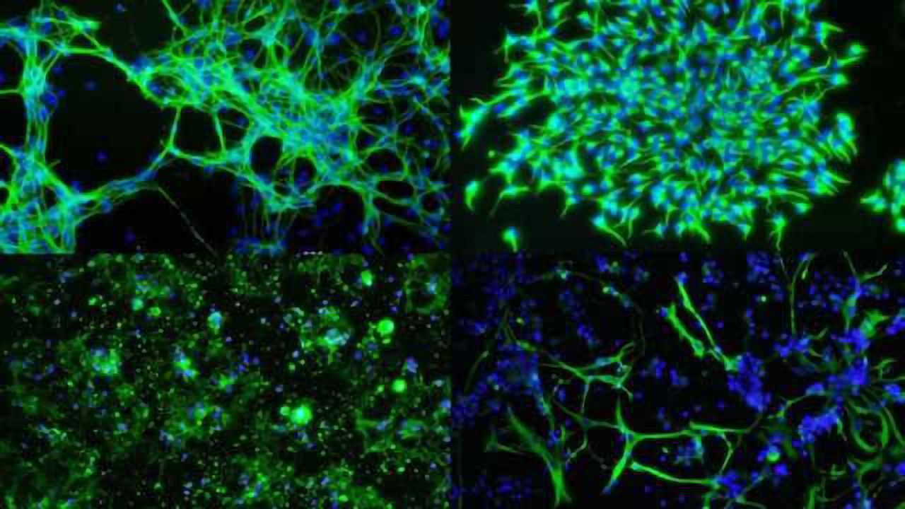 High efficiency mRNA delivery with mRNA-In™ & mRNA-In™ Neuro