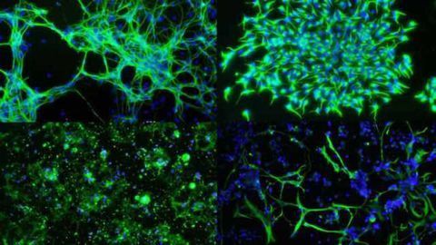 High efficiency mRNA delivery with mRNA-In™ & mRNA-In™ Neuro