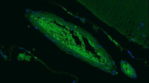 SNARE Complex Antibodies from Cedarlane