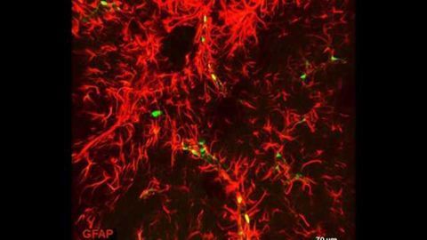 Clearing with the X-CLARITY™ leaves Col1a1-GFP intact and vibrant