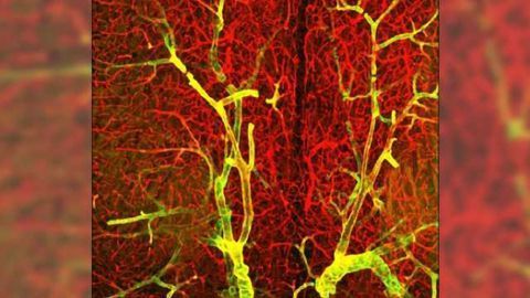 Antibody labeling of tissues cleared with the X-CLARITY™