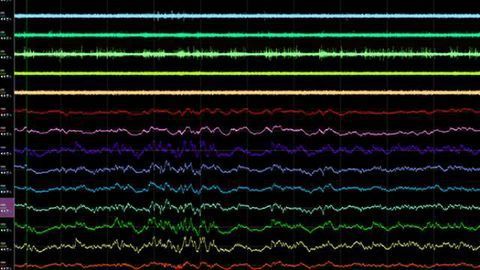 Cheetah 5.7 Software – Now Available for Beta testing!
